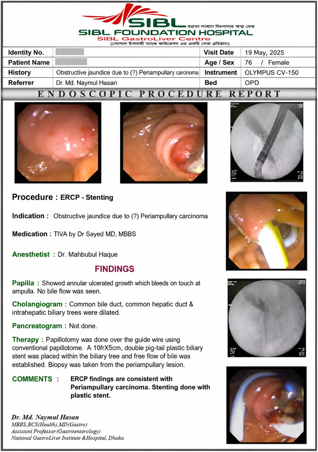 ERCP-এর সময় biliary intervention