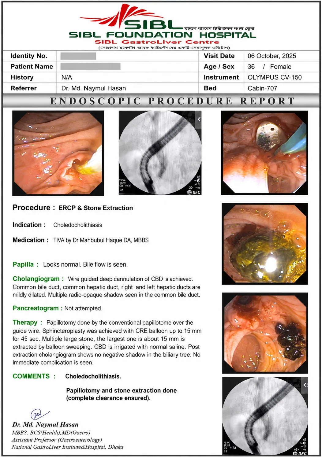 ERCP-এর সময় biliary intervention