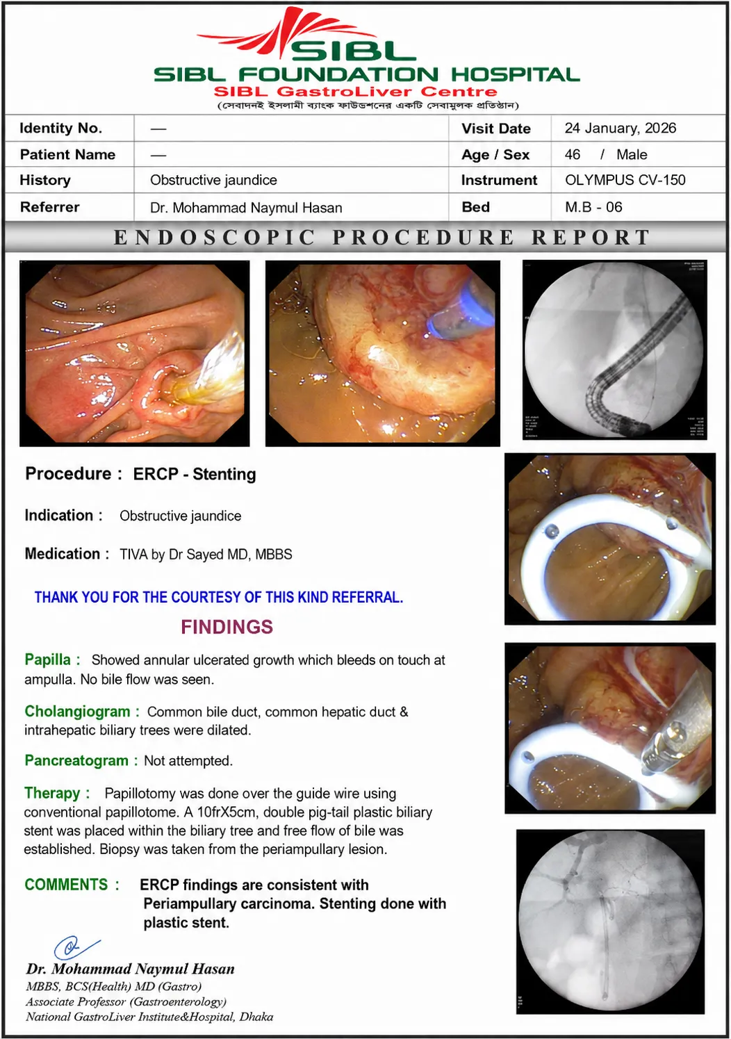 ERCP চলাকালীন endoscopic view